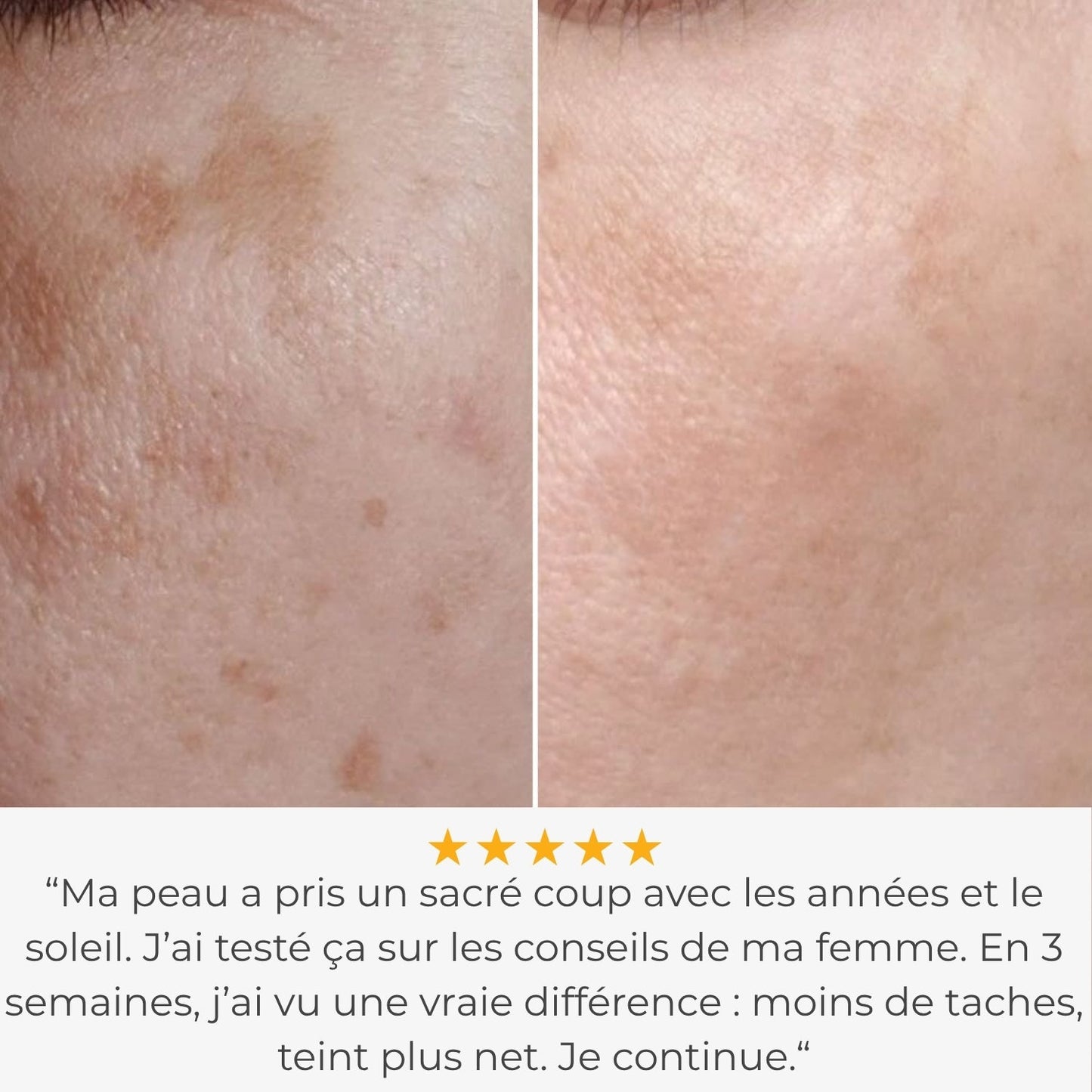 Glowskin Pro2 - Masque LED Haute Performance pour le Visage et le Cou