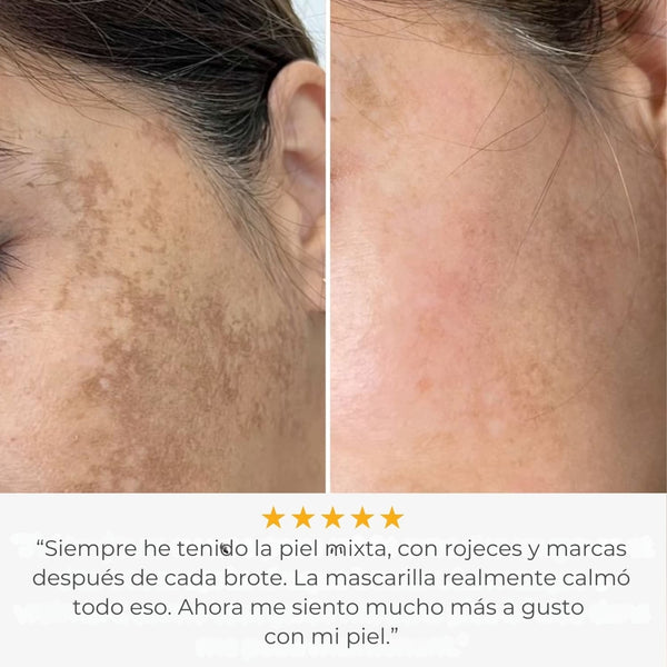 Glowskin Pro – Mascarilla LED de Alto Rendimiento para Rostro y Cuello