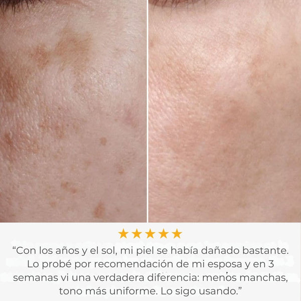 Glowskin Pro – Mascarilla LED de Alto Rendimiento para Rostro y Cuello
