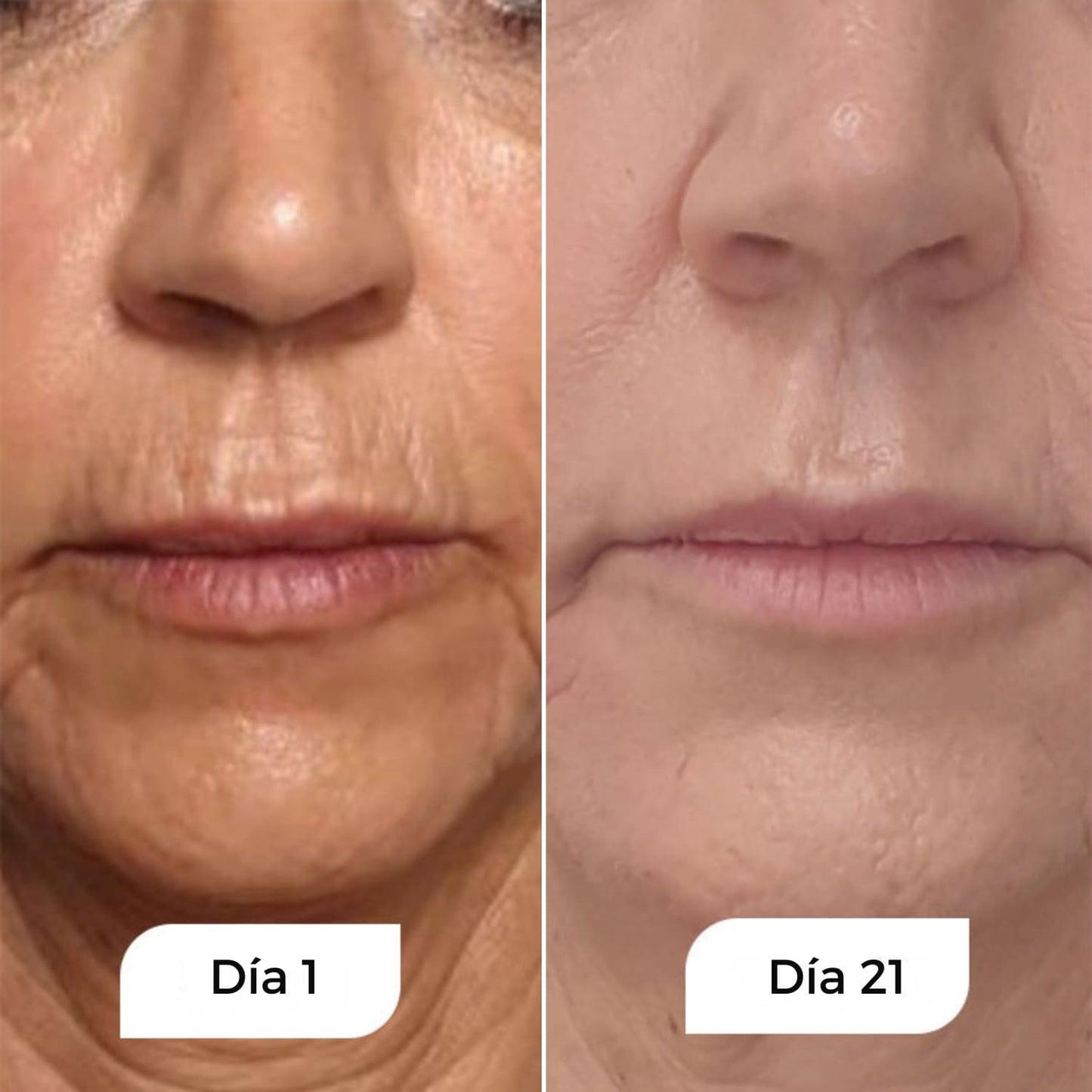 Rejuven – Suero de Noche Anti-Edad