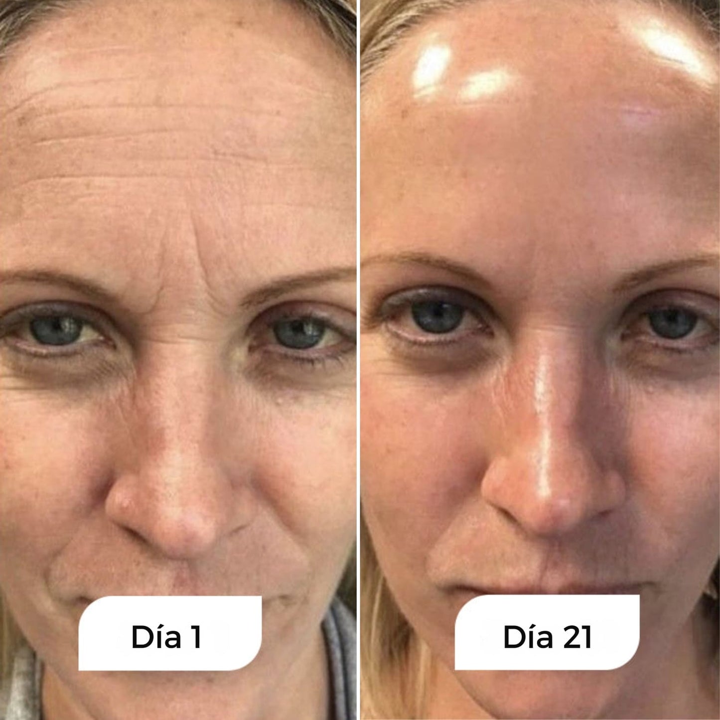 Rejuven – Suero de Noche Anti-Edad