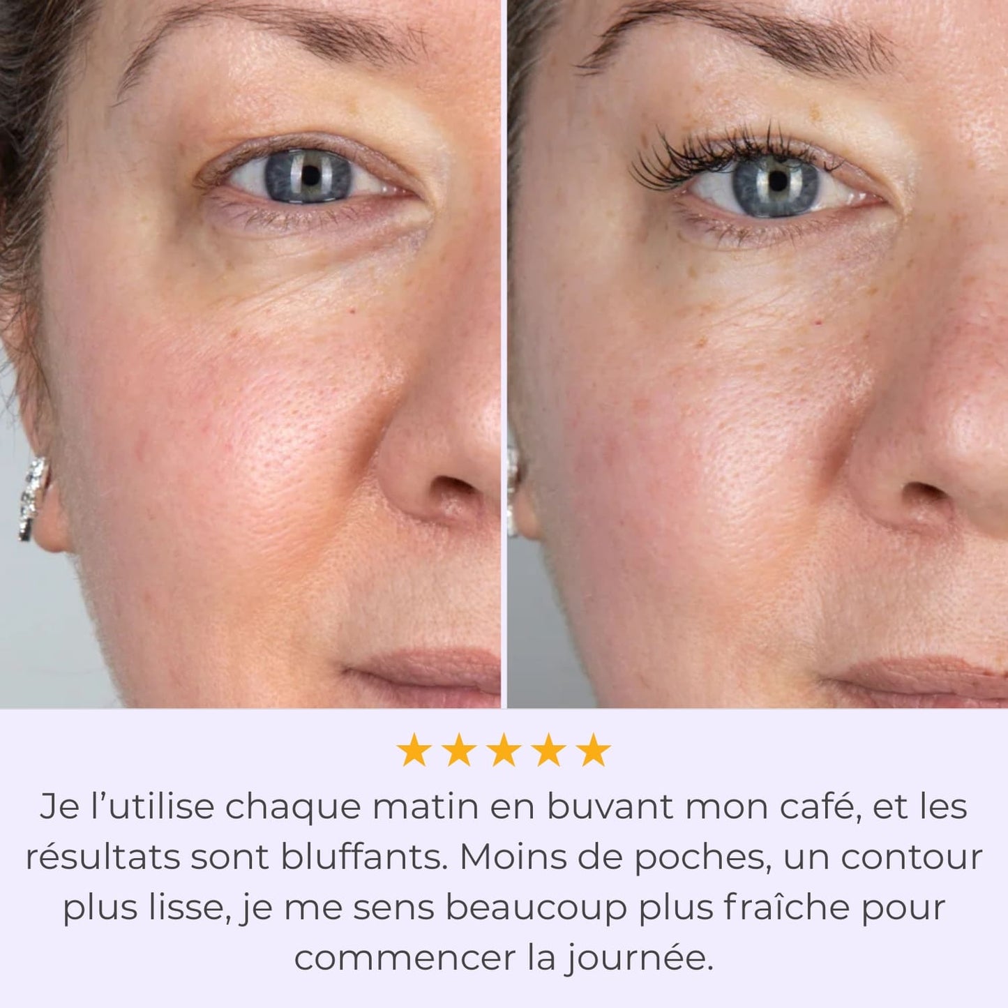 LumiEyes™ - Technologie Anti-Cernes