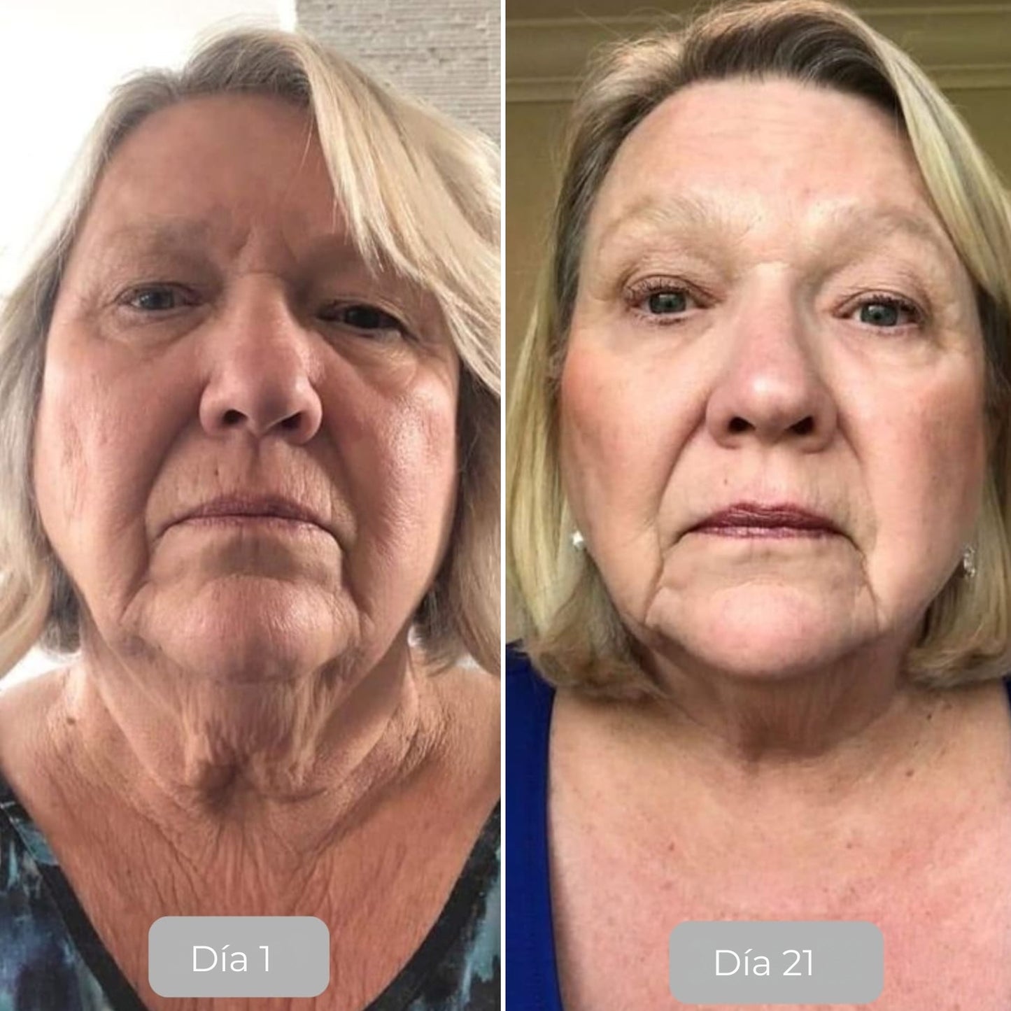 Luminate Suero Facial Vitamina C